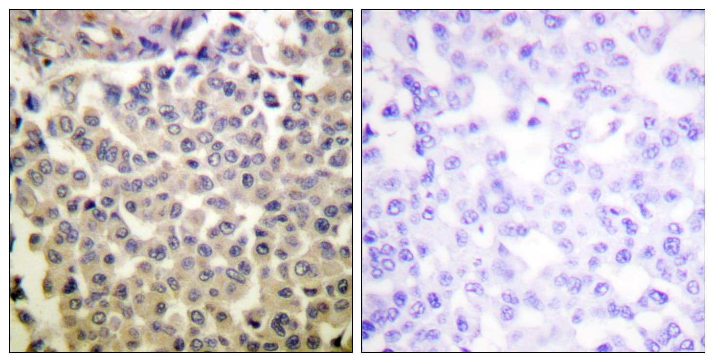 PAK1 + PAK2 + PAK3 Antibody (phospho-Thr423/Thr402/Tyr421)