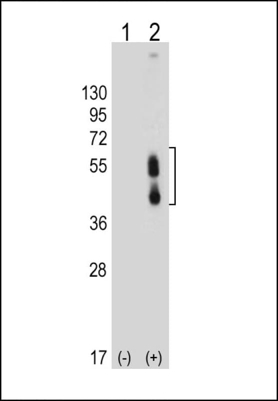 PD-L2 / PDCD1LG2 / CD273 Antibody (N-Terminus, clone 2011CT241.19.54)