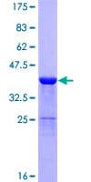 Human DBI / ACBD1 Protein (Recombinant GST)