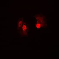 Polyclonal Rabbit anti-Human BRAF / B-Raf Antibody (Internal, IHC, IF, WB)