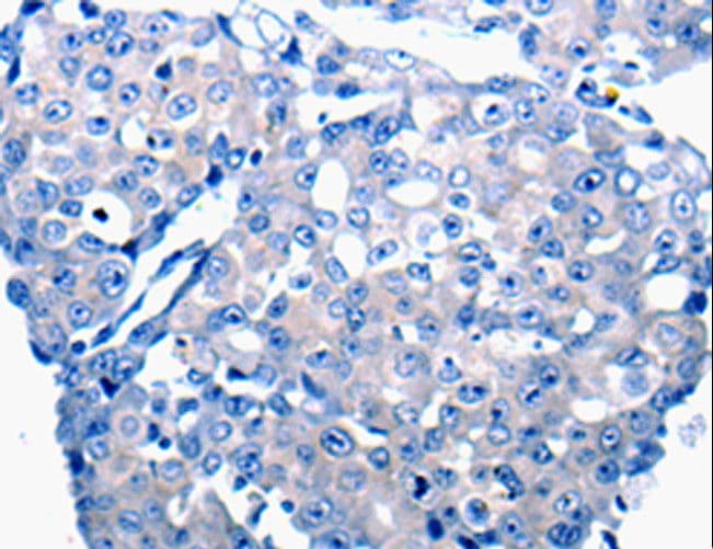 CCL2 / MCP1 Antibody