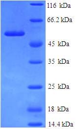 Human ANXA9 Protein (Recombinant His-SUMO)