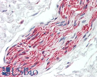 IHC-plus™ FGD6 Antibody