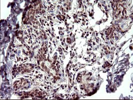 PARVA Antibody (clone OTI1C10)