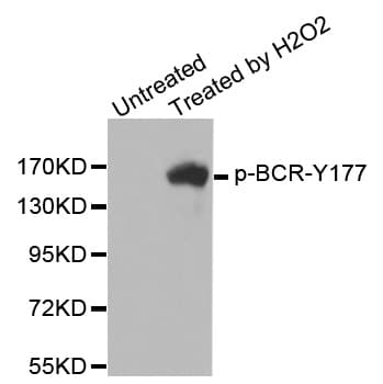 Polyclonal Rabbit anti-Human CML / BCR Antibody (phospho-Tyr177, IHC, WB)