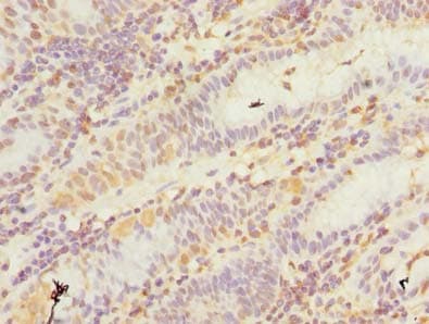 Polyclonal Rabbit anti-Human GHITM Antibody (IHC, WB)