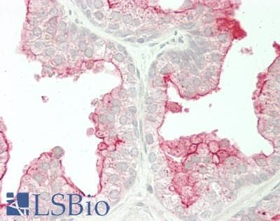 IHC-plus™ Polyclonal Rabbit anti-Human TMPRSS2 / Epitheliasin Antibody (IHC, WB)