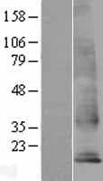 TM4SF18 Protein (Over-Expression Lysate Myc-DDK (Flag))