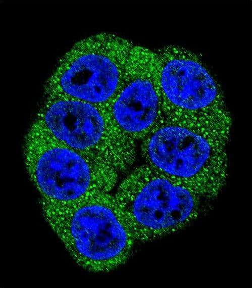 Polyclonal Rabbit anti-Human PFKM / PFK-1 Antibody (aa746-776, IHC, IF, WB)