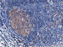 Monoclonal Mouse anti-Human ATG3 Antibody (clone OTI2C12, IHC, IF, WB)