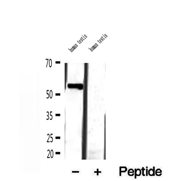 Polyclonal Rabbit anti-Human MLYCD / MCD Antibody (IHC, IF, WB)