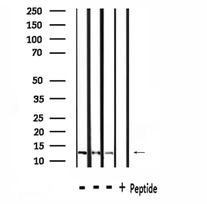 NDUFA4L2 Antibody