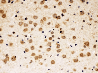ABR Antibody