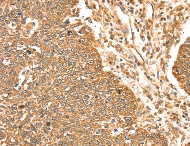 Polyclonal Rabbit anti-Human MAPK7 / ERK5 Antibody (IHC, WB)
