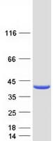 Human GALE / UDP-Glucose 4-Epimerase Protein (Recombinant Myc-DDK (Flag))