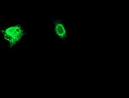 Adiponectin Antibody (aa19-244, clone OTI1H1, Carrier-free)