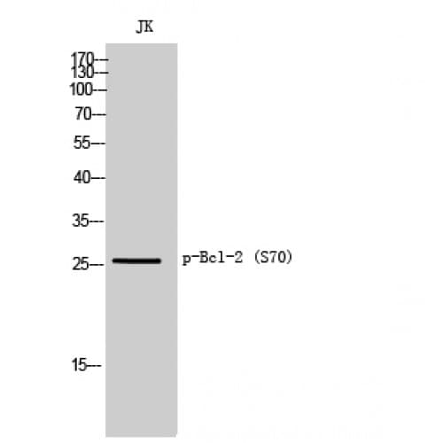 BCL2 / Bcl-2 Antibody (10-90 aa)