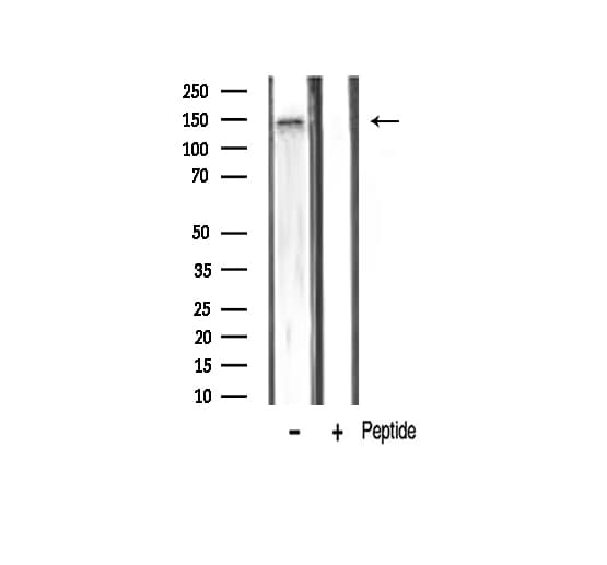 KDR / VEGFR2 / FLK1 Antibody (phospho-Tyr1059)