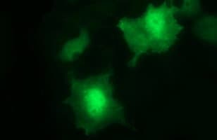 UPRT Antibody (clone OTI2D10)