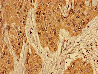 RPL10L Antibody