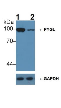 PYGL Antibody (aa341-509)