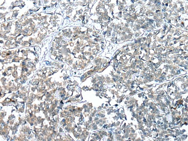 COMMD6 Antibody