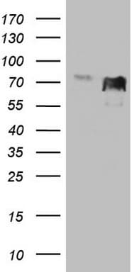 MYCN / N-myc Antibody (aa229-464, clone OTI1D6)