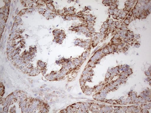Monoclonal Mouse anti-Human NAPSA / NAPA / Napsin A Antibody (clone OTI3C6, aa64-244, IHC)