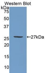 PML Antibody (aa59-239)