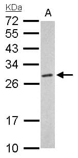 Polyclonal Rabbit anti-Human PSMA6 Antibody (aa57-274, IHC, WB)