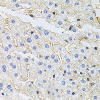 IGF1R / IGF1 Receptor Antibody