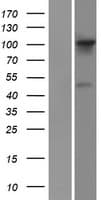 FGD1 Protein (Over-Expression Lysate Myc-DDK (Flag))