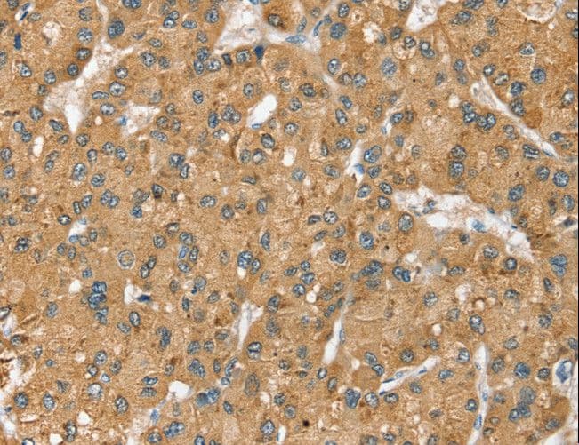 Polyclonal Rabbit anti-Human SEC14L2 Antibody (IHC, WB)