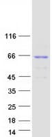 Human KLHL30 Protein (Recombinant Myc-DDK (Flag))