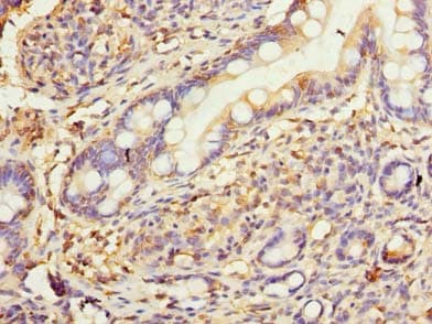 HSD17B12 Antibody
