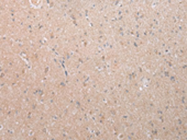 DEFB112 Antibody
