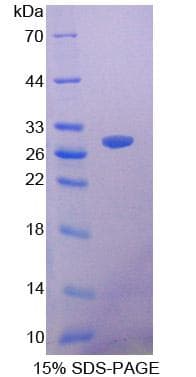 Human SIRPB1 / CD172b Protein (Recombinant His, N-Terminal)
