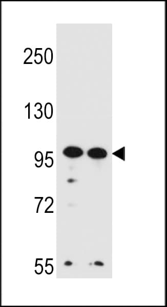 Polyclonal Rabbit anti-Human WDR3 Antibody (aa208-236, WB)
