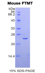 Mouse FTMT / MTF Protein (Recombinant His)