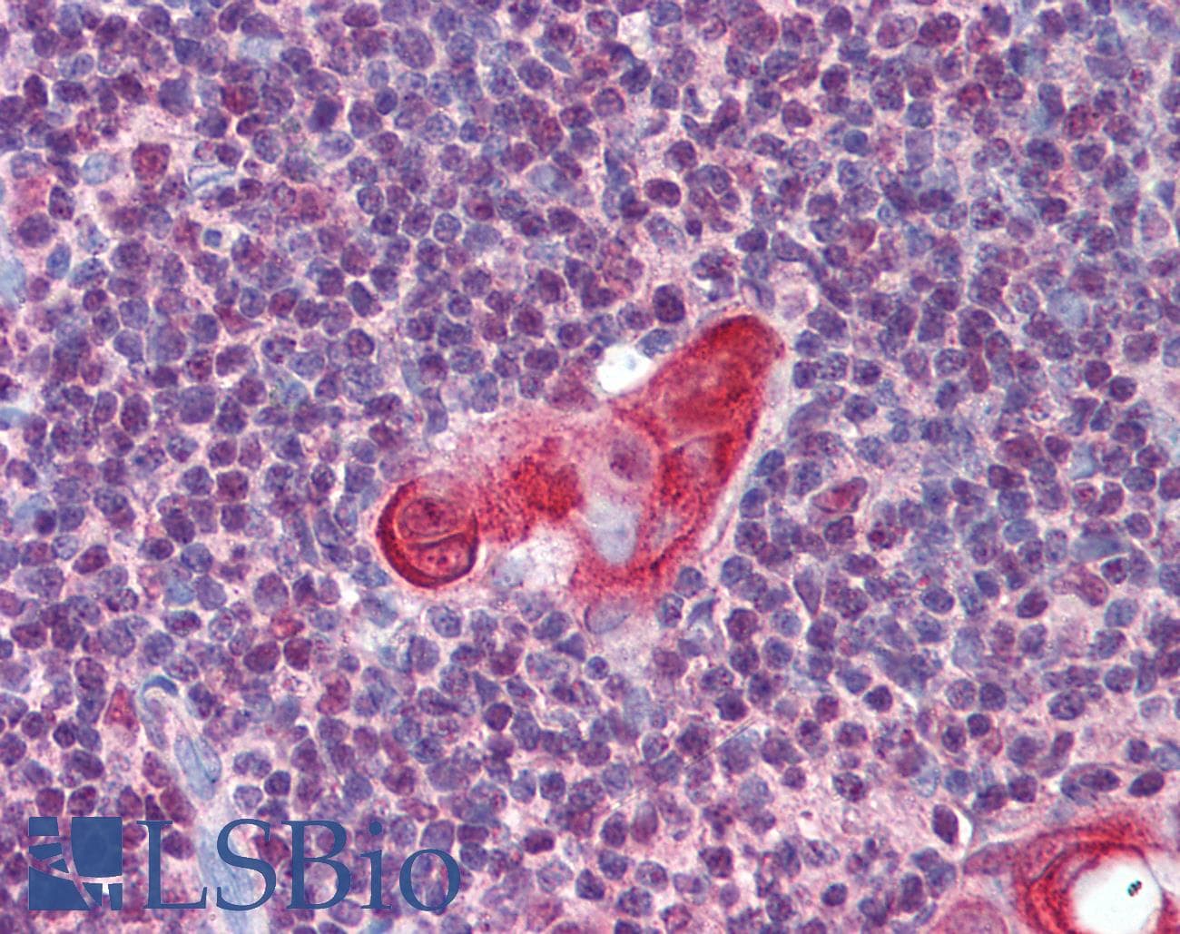 IHC-plus™ TLX1 / HOX11 Antibody (aa306-318)