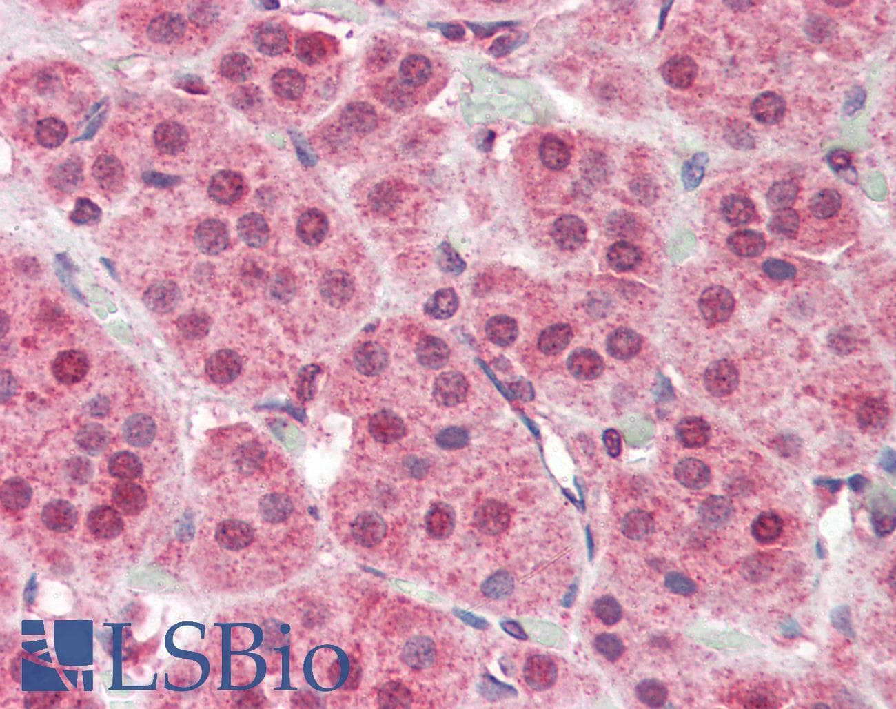 IHC-plus™ PARP2 Antibody (aa389-401)