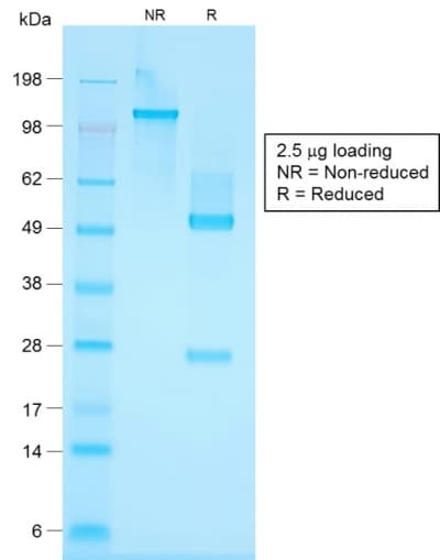 KRT76 / Keratin 76 Antibody (clone KRTH/1576R)