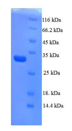 Rat AGTR2 / AT2 Receptor Protein (Recombinant GST, N-terminus)