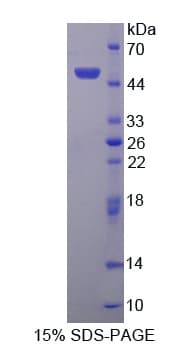 Human PPIC / Cyclophilin C Protein (Recombinant His-GST-S)