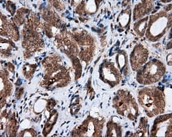 AKR1A1 Antibody (clone OTI4G6)