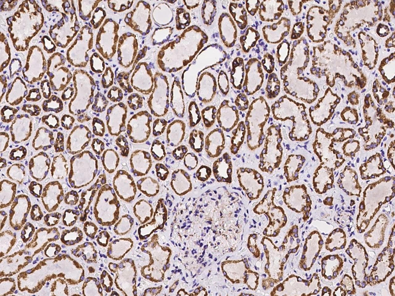 UQCRC1 Antibody
