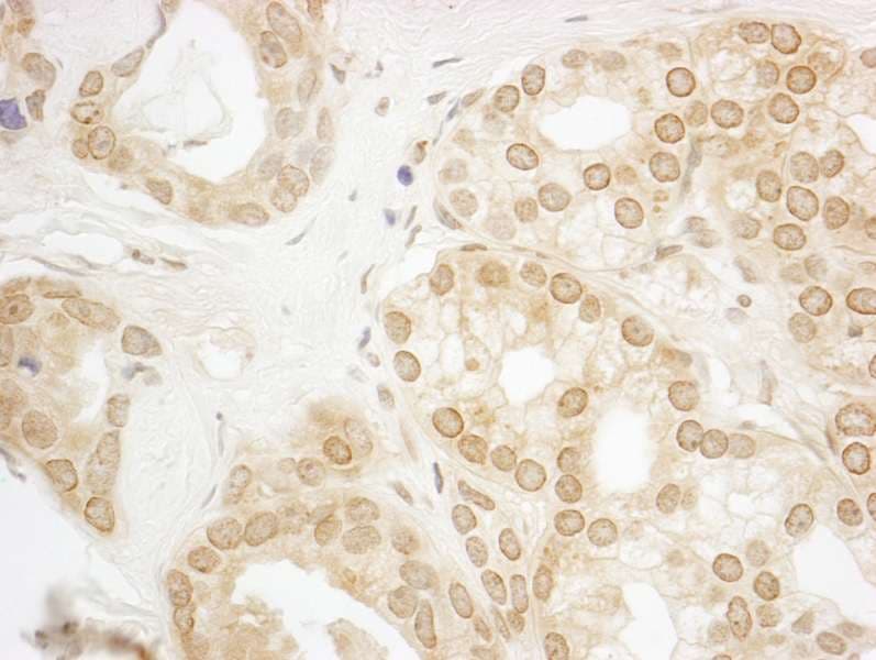 Polyclonal Rabbit anti-Human PPP3CA / CCN1 / Calcineurin A Antibody (aa470-C-term, IHC)
