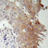 IRS1 Antibody (Internal)