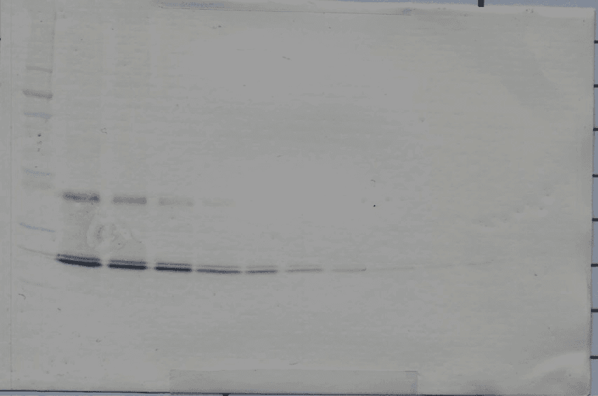 Polyclonal Rabbit anti-Human IL11 Antibody (Biotin, WB)