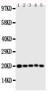 Polyclonal Rabbit anti-Human CASP4 / Caspase 4 Antibody (aa104-124, IHC, WB)